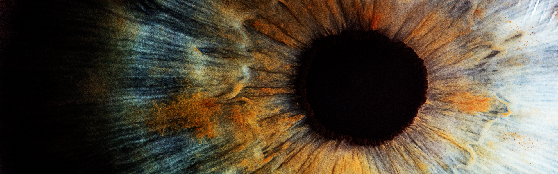 Vida Trümpelmann Orbital Implants and digital iris colour specialists
